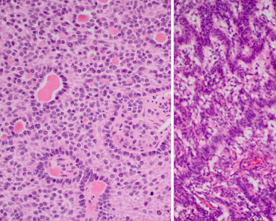 patologia,patologistas,patologia especializada,patologistas especializados,diagnóstico,diagnósticos,laboratório,laboratórios,brasil,são paulo,segunda opinião,exame,biopatologia,dermatopatologia